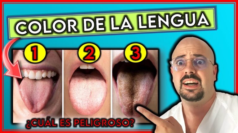 colores de la lengua y su significado