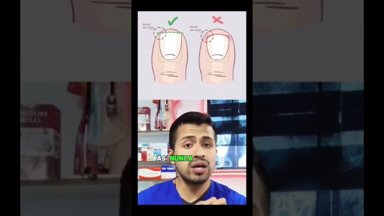 como se llama la fobia a cortarse las uñas