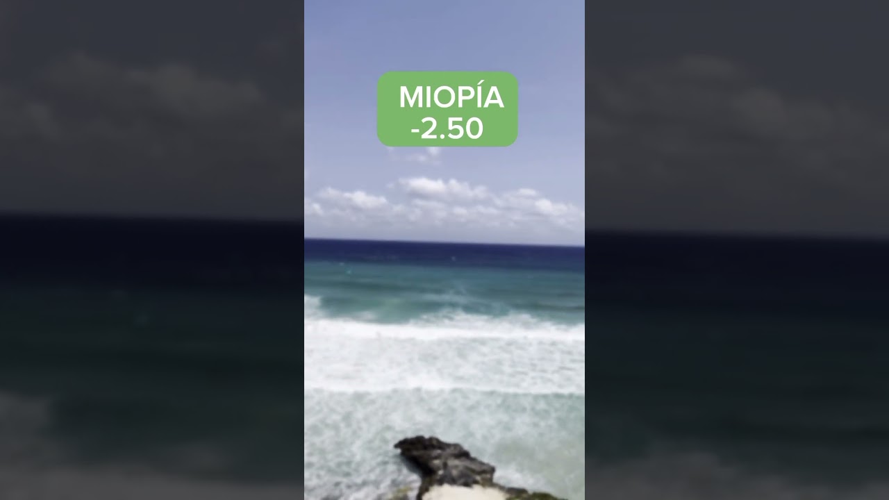 como ve un miope con 7 dioptrias