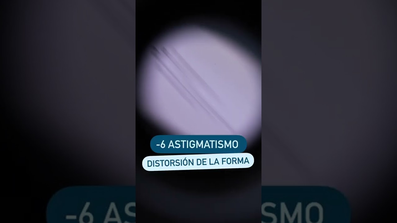 como ve una persona con 7 de miopia